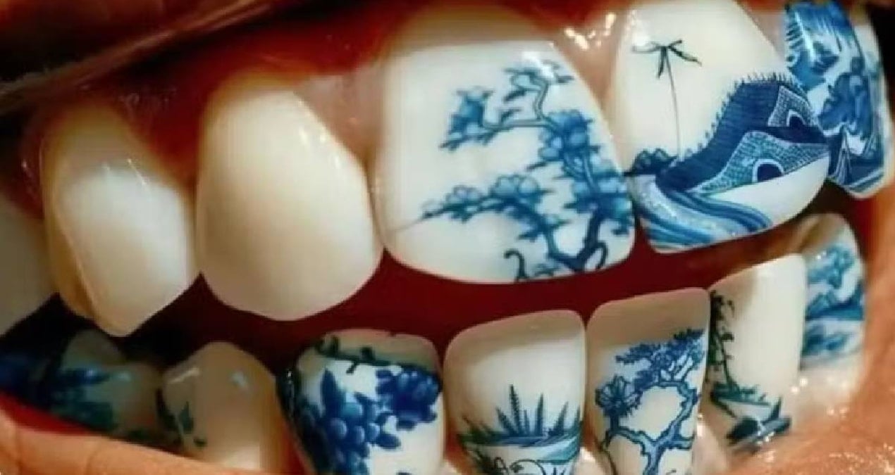 sonunda bu da oldu dis dovmeleri giderek yayginlasiyor 5QNK8lN2